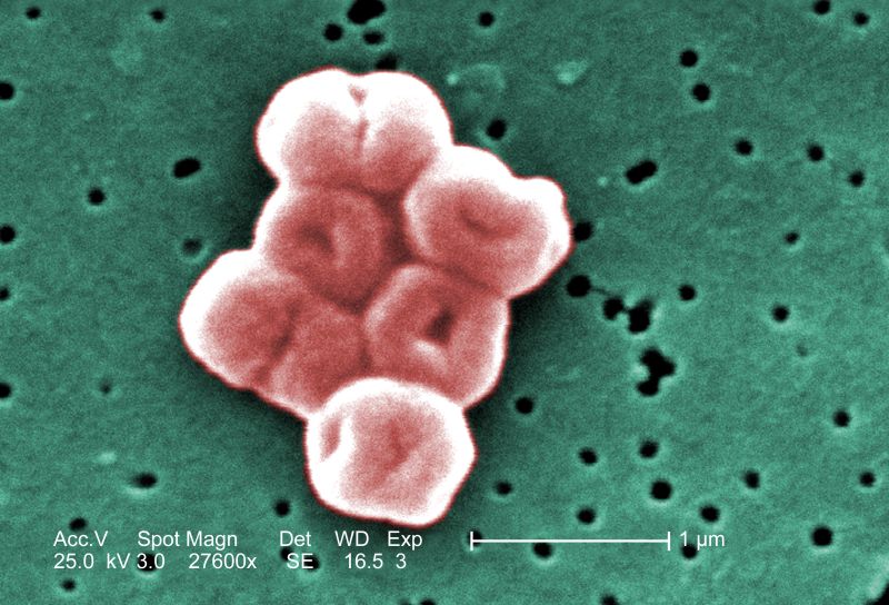 Acinetobacter