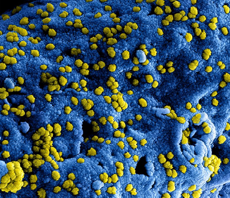 corona virus MERS 02
