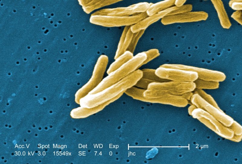 mycobacterium tuberculosis