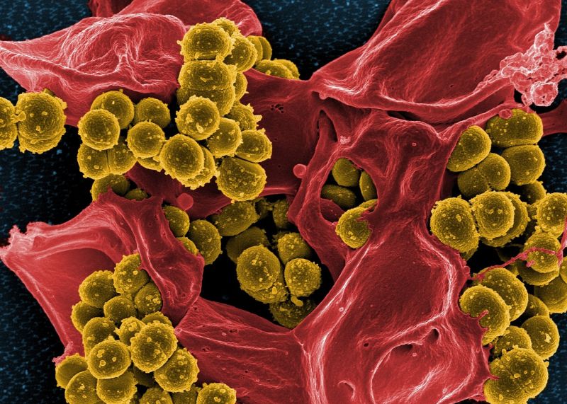 staphylococcus aureus